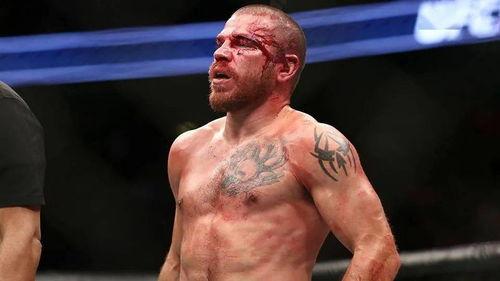UFC比赛在哪买输赢的东西呢？带你飞梭这条“打脸路线”！